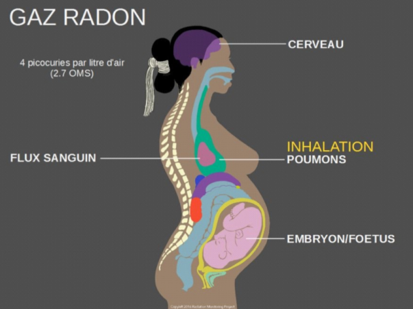 Radon.png